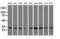 F-actin-capping protein subunit alpha-1 antibody, M07665-1, Boster Biological Technology, Western Blot image 