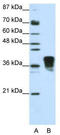 Transformer 2 Beta Homolog antibody, TA345882, Origene, Western Blot image 