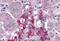 Regulating Synaptic Membrane Exocytosis 2 antibody, A09915, Boster Biological Technology, Western Blot image 
