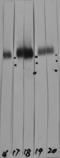 Lysosomal Associated Membrane Protein 1 antibody, LS-B10407, Lifespan Biosciences, Western Blot image 