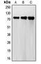 Follicle-stimulating hormone receptor antibody, LS-C352223, Lifespan Biosciences, Western Blot image 