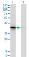 Proenkephalin-B antibody, LS-C197872, Lifespan Biosciences, Western Blot image 