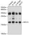Ribosomal Protein S15 antibody, 19-953, ProSci, Western Blot image 