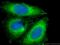 Keratin 14 antibody, 22221-1-AP, Proteintech Group, Immunofluorescence image 