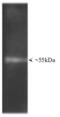 Proteasome 19S Rpt2/S4 subunit antibody, BML-PW8305-0100, Enzo Life Sciences, Western Blot image 