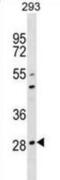 Osteoclast-associated immunoglobulin-like receptor antibody, abx030601, Abbexa, Western Blot image 
