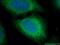 Lysosomal Associated Membrane Protein 1 antibody, 21997-1-AP, Proteintech Group, Immunofluorescence image 