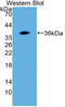 Prothrombin Fragment 1.2 antibody, LS-C722159, Lifespan Biosciences, Western Blot image 