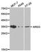 CRDGF antibody, TA327203, Origene, Western Blot image 