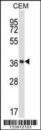 NFKB Inhibitor Beta antibody, 57-267, ProSci, Western Blot image 