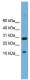 TAL BHLH Transcription Factor 2 antibody, TA341815, Origene, Western Blot image 