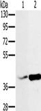 NADH:Ubiquinone Oxidoreductase Subunit A10 antibody, TA350204, Origene, Western Blot image 
