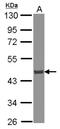 ATPase H+ Transporting V0 Subunit D1 antibody, NBP2-15517, Novus Biologicals, Western Blot image 