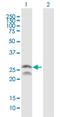 FEV Transcription Factor, ETS Family Member antibody, H00054738-B02P, Novus Biologicals, Western Blot image 