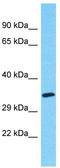 Myeloid Associated Differentiation Marker Like 2 antibody, TA337449, Origene, Western Blot image 