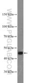 Killer Cell Lectin Like Receptor D1 antibody, 13332-1-AP, Proteintech Group, Western Blot image 