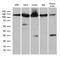 Importin 5 antibody, LS-C796178, Lifespan Biosciences, Western Blot image 
