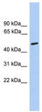 Cholinergic Receptor Nicotinic Alpha 5 Subunit antibody, TA338362, Origene, Western Blot image 