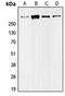Ubiquitin Protein Ligase E3 Component N-Recognin 5 antibody, LS-C353442, Lifespan Biosciences, Western Blot image 