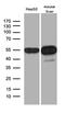Aldehyde Dehydrogenase 7 Family Member A1 antibody, MA5-27437, Invitrogen Antibodies, Western Blot image 