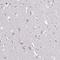 Glucuronic Acid Epimerase antibody, NBP2-31872, Novus Biologicals, Immunohistochemistry paraffin image 