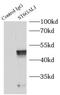 ST6 Beta-Galactoside Alpha-2,6-Sialyltransferase 1 antibody, FNab10130, FineTest, Immunoprecipitation image 