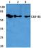 Corticotropin Releasing Hormone Receptor 1 antibody, AP01194PU-N, Origene, Western Blot image 