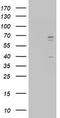 CD5 Molecule antibody, LS-C789517, Lifespan Biosciences, Western Blot image 
