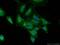 Death-associated protein kinase 1 antibody, 25136-1-AP, Proteintech Group, Immunofluorescence image 