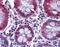 Stearoyl-CoA Desaturase antibody, NB100-2476, Novus Biologicals, Immunohistochemistry paraffin image 