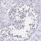 Coiled-Coil Domain Containing 105 antibody, NBP2-32391, Novus Biologicals, Immunohistochemistry paraffin image 