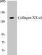 Collagen Type XX Alpha 1 Chain antibody, EKC1133, Boster Biological Technology, Western Blot image 
