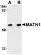 Matrilin 1 antibody, orb75181, Biorbyt, Western Blot image 