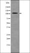 Receptor Tyrosine Kinase Like Orphan Receptor 2 antibody, orb336112, Biorbyt, Western Blot image 