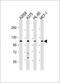 Collagen Type XVII Alpha 1 Chain antibody, GTX80563, GeneTex, Western Blot image 