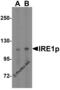 Serine/threonine-protein kinase/endoribonuclease IRE1 antibody, 3655, ProSci Inc, Western Blot image 