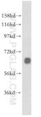 MARCKS Like 1 antibody, 10002-2-AP, Proteintech Group, Western Blot image 