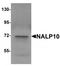 NLR Family Pyrin Domain Containing 10 antibody, TA320167, Origene, Western Blot image 