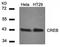 CREB Binding Protein antibody, orb14650, Biorbyt, Western Blot image 