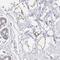 Chromosome 19 Open Reading Frame 12 antibody, PA5-61375, Invitrogen Antibodies, Immunohistochemistry frozen image 