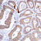 Mitogen-Activated Protein Kinase Kinase 1 antibody, LS-C354252, Lifespan Biosciences, Immunohistochemistry paraffin image 