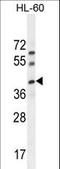 BLOC-1 Related Complex Subunit 6 antibody, LS-C167955, Lifespan Biosciences, Western Blot image 