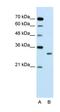 SBDS Ribosome Maturation Factor antibody, orb330442, Biorbyt, Western Blot image 