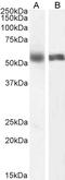 Cytochrome P450 Family 2 Subfamily C Member 8 antibody, 42-881, ProSci, Western Blot image 