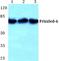 Frizzled Class Receptor 6 antibody, A04241, Boster Biological Technology, Western Blot image 