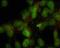 Human Nuclei antibody, AT002, Boster Biological Technology, Immunofluorescence image 