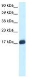 E2F Transcription Factor 6 antibody, TA330204, Origene, Western Blot image 