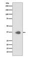 Paired box protein Pax-9 antibody, M03356, Boster Biological Technology, Western Blot image 
