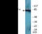 Protein Kinase C Epsilon antibody, EKC2202, Boster Biological Technology, Western Blot image 