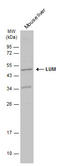 Lumican antibody, GTX131377, GeneTex, Western Blot image 
